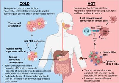 Exercise to transform tumours from cold to hot and improve immunotherapy responsiveness